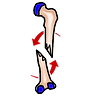 Bone Break or Fracture Urgent Care Services